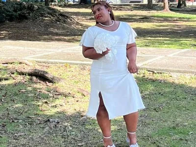 Caso Rebecca Brizard: barbero ya había operado a otras pacientes